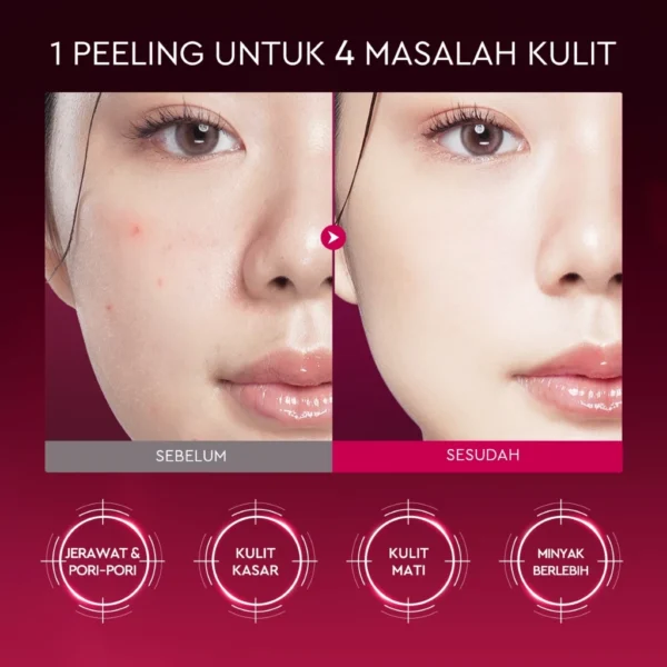Elformula Intensive Peeling Solution