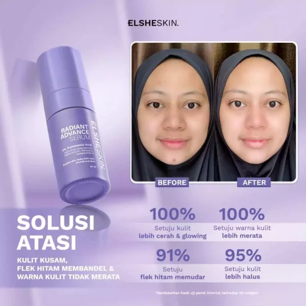 Elsheskin Radiant Advance Serum