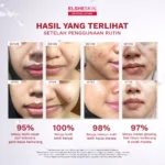 Elsheskin Retinal Advance Serum
