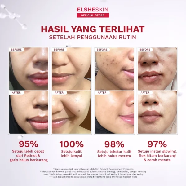 Elsheskin Retinal Advance Serum