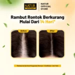 Natur Hair Tonic Hair Fall Treatment