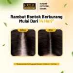 Natur Shampoo Hair Fall Treatment
