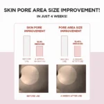 SKIN1004 Pore Care Poremizing Fresh Ampoule