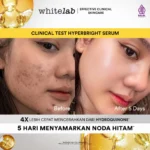 Whitelab Hyperbright Serum