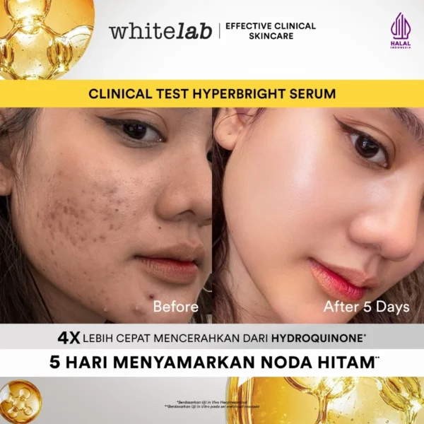 Whitelab Hyperbright Serum