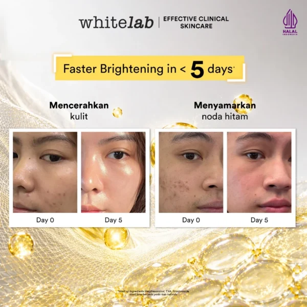 Whitelab Hyperbright Serum